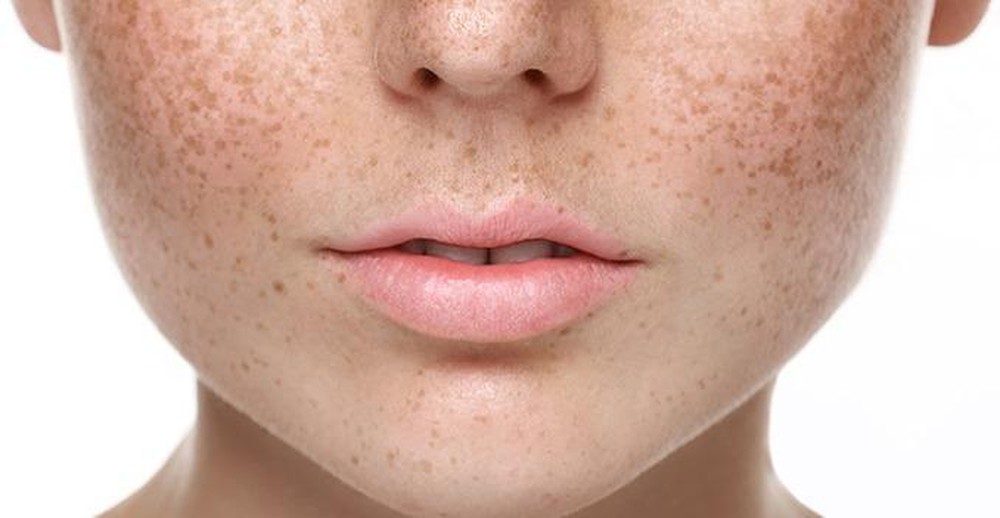 Tìm hiểu về các nguyên nhân gây sạm, nám da mặt - Tạp chí Đời Sống ...