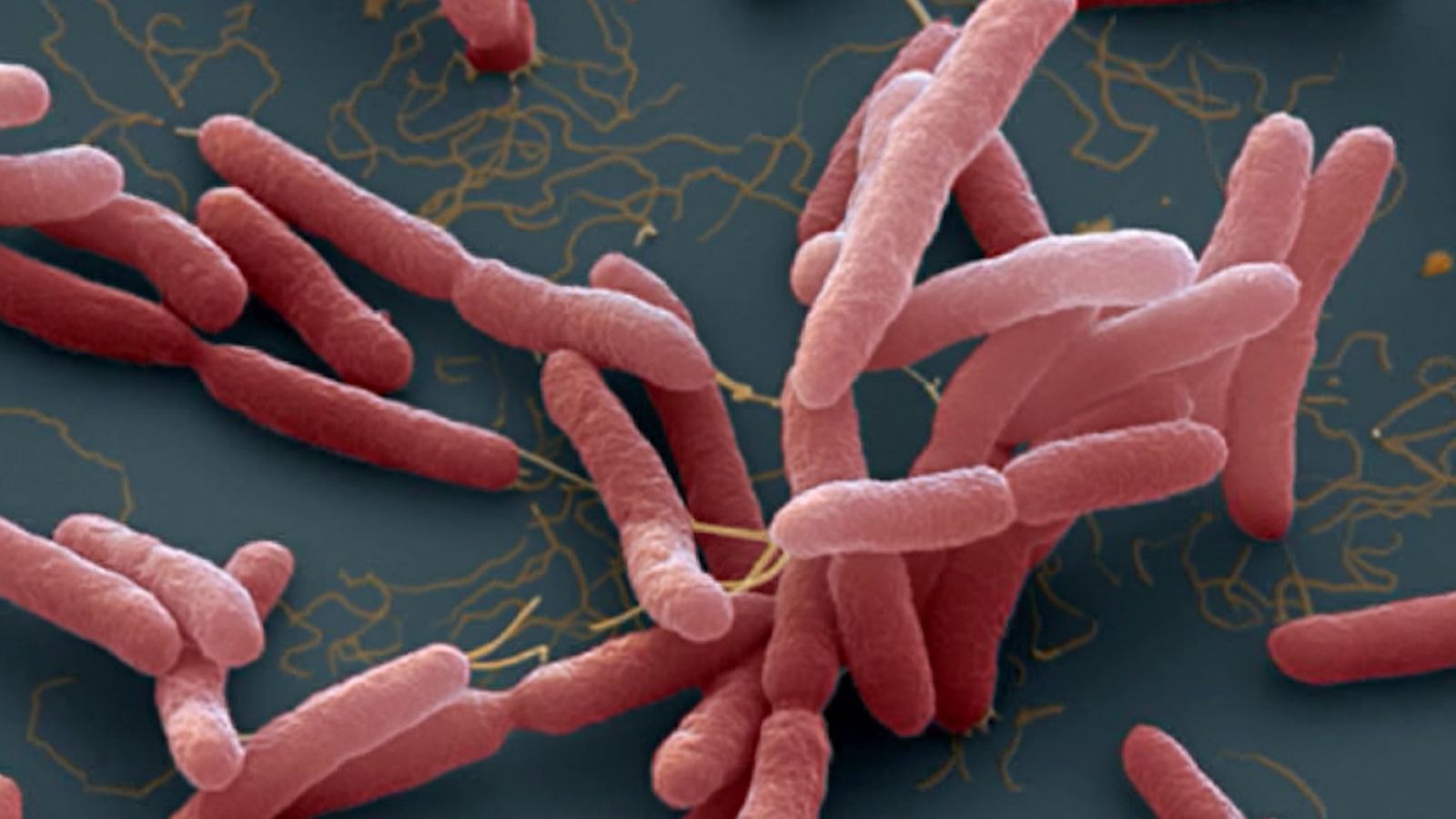 Bệnh Melioidosis (Bệnh Whitmore)