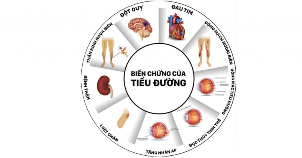 Biến chứng của đái tháo đường mà bạn cần phải biết