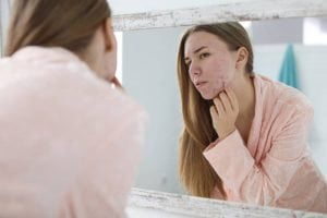 Làm sạch da mặt bị mụn giúp giảm thâm, mau lành